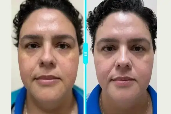 Lúcia Moraes, 35 anos